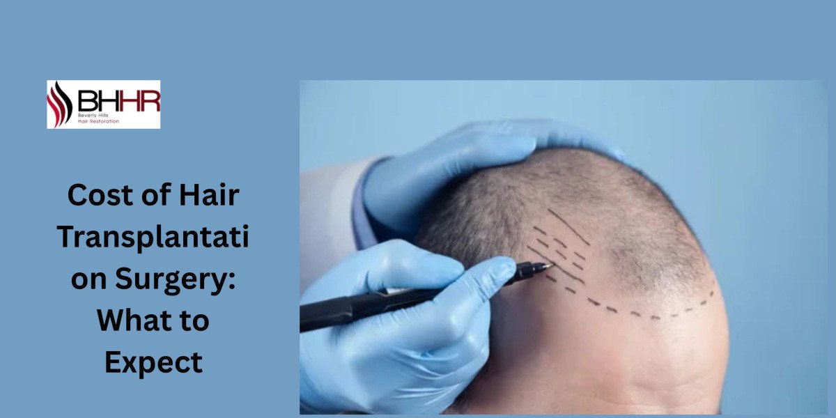 Cost of Hair Transplantation Surgery: What to Expect