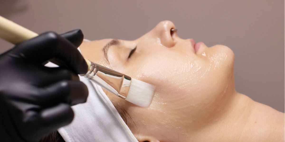 Are Chemical Peels Safe for Indian Skin? What You Should Know