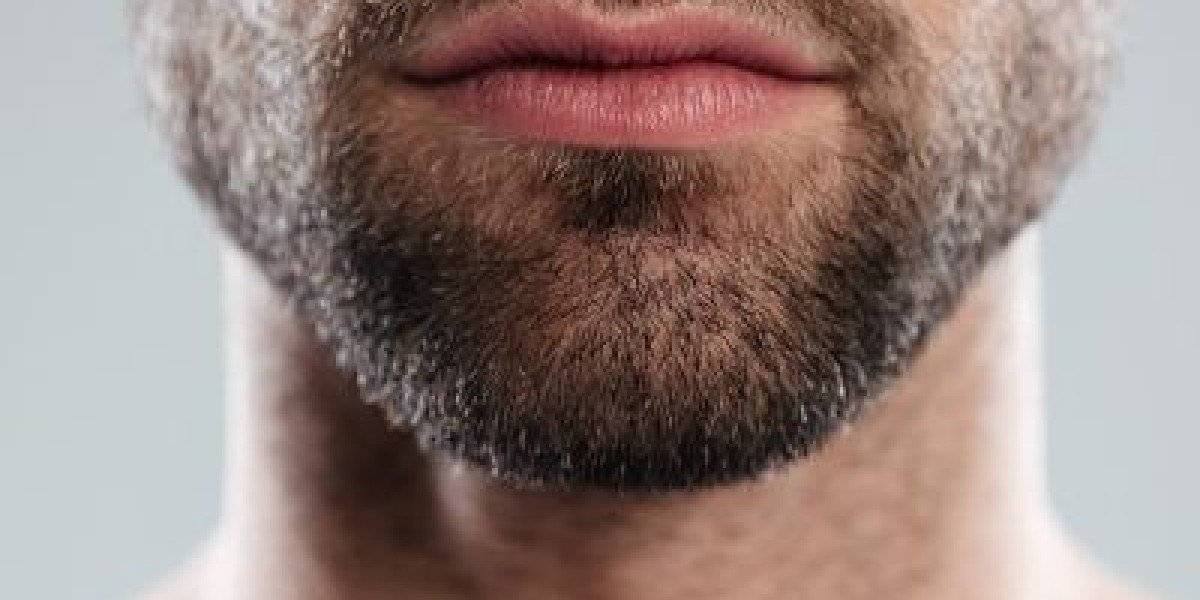 Beard Transplant in Dubai Achieve Fuller Natural Looking Beard